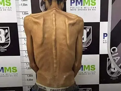 Aparência debilitada choca em quarta prisão de foragido viciado em Dourados