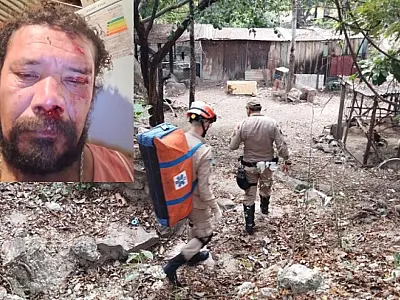 Onça-pintada ataca cachorro e fere dono no Pantanal; grupo descarta 'ataque' e classifica caso como incidente