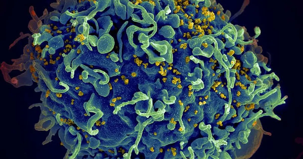 Paciente teria se curado do HIV com imunidade natural