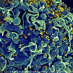 Paciente teria se curado do HIV com imunidade natural